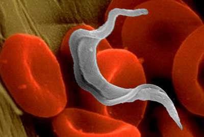 Trypanosoma cruzi: Imagen tomada con un microscopio electrónico del Trypanosoma cruzi rodeado de globulos rojos.:left