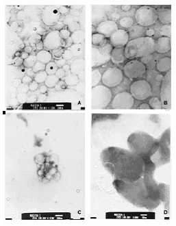 Liposomas con y sin cobertura PCS : Fotografías de microscopía electrónica de liposomas sin cobertura PCS (A y B) y con cobertura PCS (C y D).:left