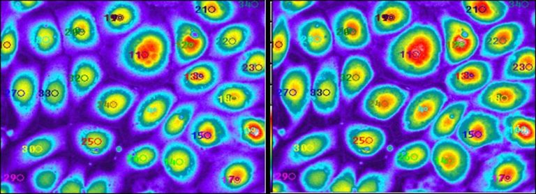 Figura: células cargadas con un compuesto fluorescente antes (izquierda) y después (derecha) de ser bañadas con medio hipotónico.