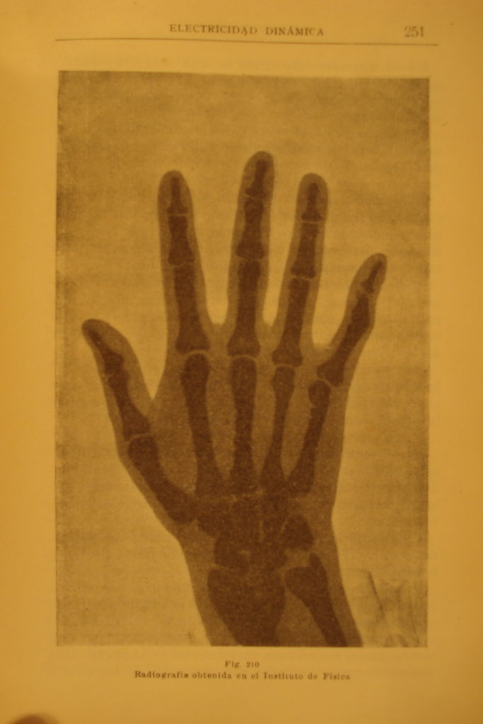 Mano humana: una de las primeras imágenes de radiografías obtenidas en Argentina (Instituto de Física La Plata).