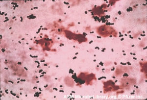 Streptococcus agalactiae: Fuente: MicrobeLibrary.org:left
